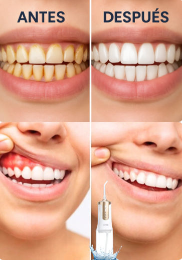 AquaDent™- Higiene dental avanzada